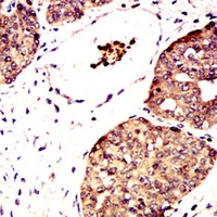 19 - Anti-Metadherin Antibody AP95963