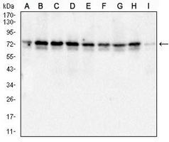 1 - Anti-Metadherin Antibody AP95963