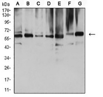 1 - Anti-ARD1 Antibody AP95966