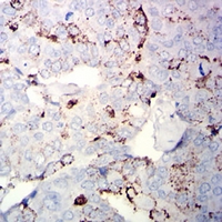 19 - Anti-CD56 Antibody AP95968