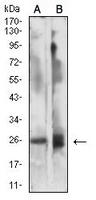 1 - Anti-CD337 Antibody AP95970