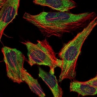 3 - Anti-NEFL Antibody AP95974