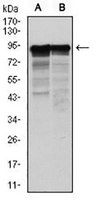 1 - Anti-NEFL Antibody AP95974