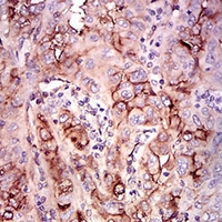 19 - Anti-CD73 Antibody AP95981