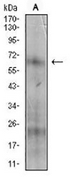 1 - Anti-CD73 Antibody AP95981