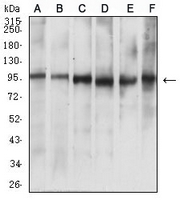 1 - Anti-NUP98 Antibody AP95982