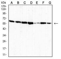 1 - Anti-OTUB2 Antibody AP95983