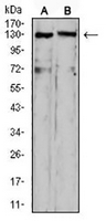 1 - Anti-OTUD4 Antibody AP95984