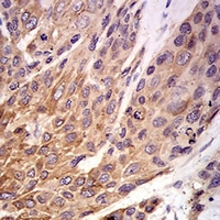 19 - Anti-P2RX7 Antibody AP95985