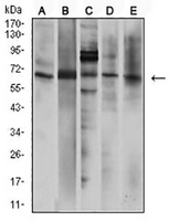1 - Anti-P2RX7 Antibody AP95985