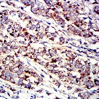 19 - Anti-P2Y1 Antibody AP95986