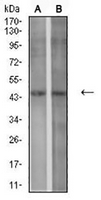 1 - Anti-P2Y1 Antibody AP95986
