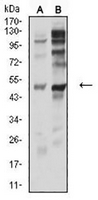 1 - Anti-P2Y12 Antibody AP95987