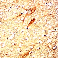 19 - Anti-DJ-1 Antibody AP95989