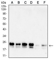 1 - Anti-DJ-1 Antibody AP95989