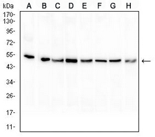 1 - Anti-PAX8 Antibody AP95990