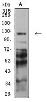 1 - Anti-Protocadherin-9 Antibody AP95991