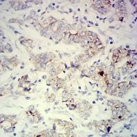 19 - Anti-PCK2 Antibody AP95992