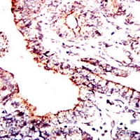 19 - Anti-PDHA1 Antibody AP95996