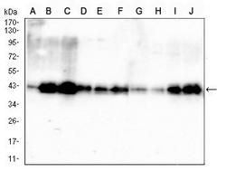 1 - Anti-PDHA1 Antibody AP95996