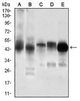 1 - Anti-PDK2 Antibody AP95997