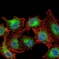 3 - Anti-PDPK1 Antibody AP95998
