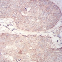 19 - Anti-PDPK1 Antibody AP95998