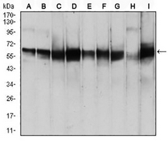 1 - Anti-PDPK1 Antibody AP95998