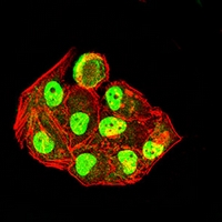 3 - Anti-Pyridoxal Kinase Antibody AP95999