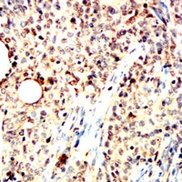 19 - Anti-Pyridoxal Kinase Antibody AP95999