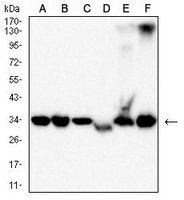 1 - Anti-Pyridoxal Kinase Antibody AP95999