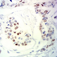 19 - Anti-Progesterone Receptor Antibody AP96000