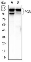 1 - Anti-Progesterone Receptor Antibody AP96000