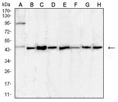 1 - Anti-uPA Antibody AP96003