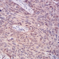 19 - Anti-PLC gamma 1 Antibody AP96004