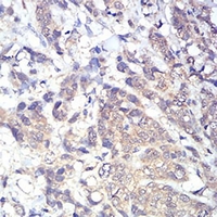 19 - Anti-PLC gamma 1 Antibody AP96005