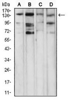1 - Anti-PLC gamma 1 Antibody AP96005
