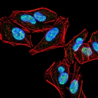 3 - Anti-PLC gamma 2 Antibody AP96006