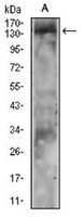 1 - Anti-PLC gamma 2 Antibody AP96006