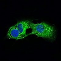 3 - Anti-Adipophilin Antibody AP96007