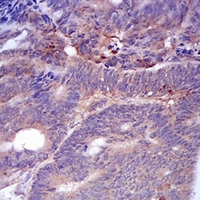 19 - Anti-Adipophilin Antibody AP96007