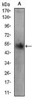 1 - Anti-Adipophilin Antibody AP96007