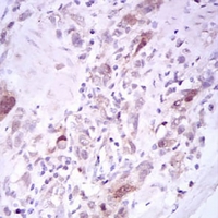 19 - Anti-PLK1 Antibody AP96009