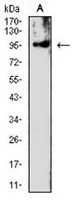 1 - Anti-PMS2 Antibody AP96010