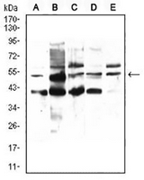 1 - Anti-PPAR alpha Antibody AP96011