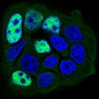 3 - Anti-PP1 beta Antibody AP96012