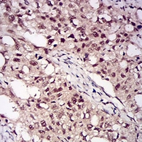 19 - Anti-PP1 beta Antibody AP96012