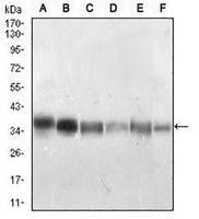 1 - Anti-PP1 beta Antibody AP96012