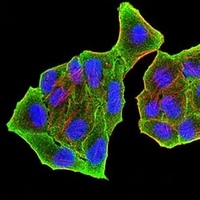 3 - Anti-PRDM5 Antibody AP96014