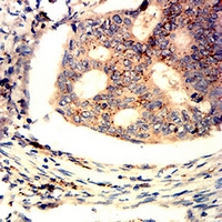 19 - Anti-Perforin 1 Antibody AP96015